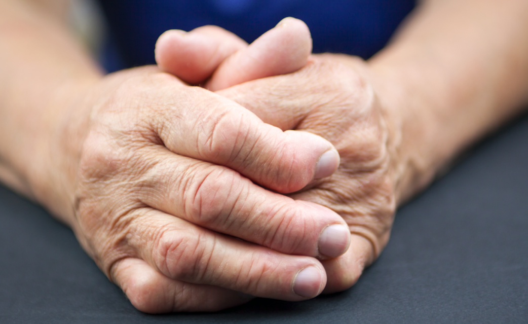 Rheumatoid Arthritis